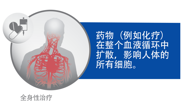 诸如化学疗法等药物如何通过血流传递（这与 Optune® 不同）