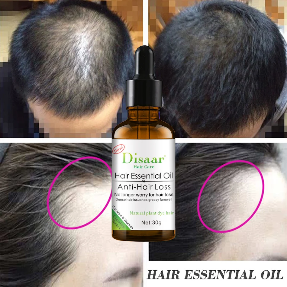 Massagem Capilar Anti-Frizz Botânico com Gengibre Reduz o Frizz Naturalmente Cabelo Macio e Brilhante Fórmula Botânica para Cuidado Capilar