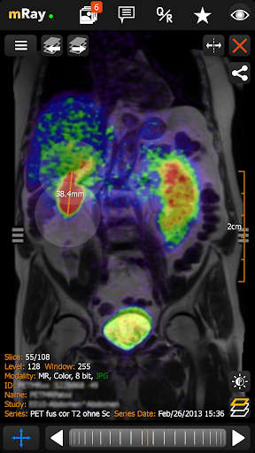 mRay - DICOM Viewer