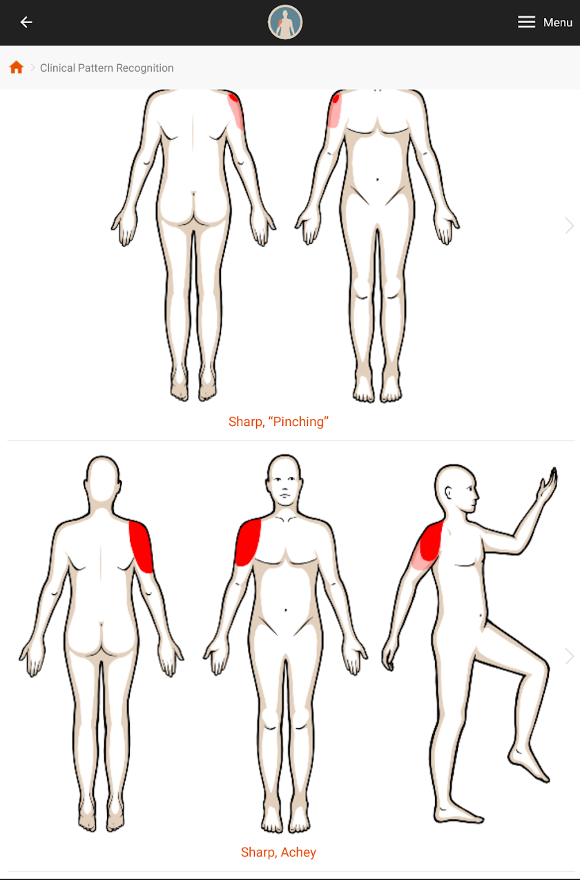 CPR: Shoulder Pain Screen 1