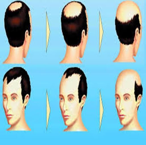 Tratamiento para Cabello Seco