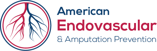 American Endovascular