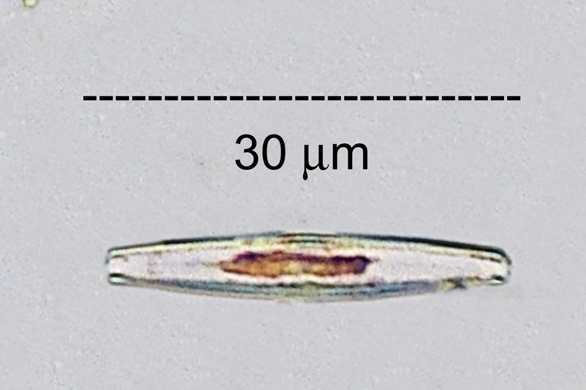 Epilithic Diatom