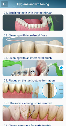 Screenshot Dental 3D Illustrations