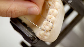 Orthodontic Retainers thumbnail