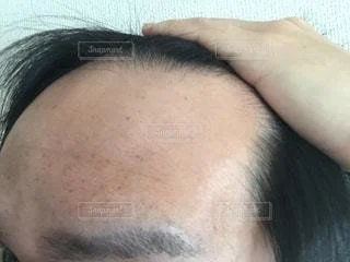 育毛剤