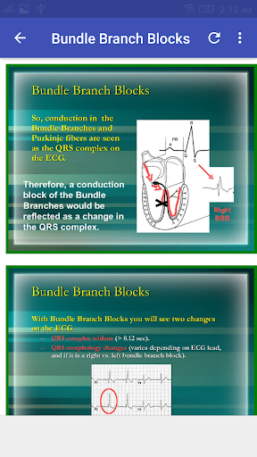 A to Z ECG Interpretation