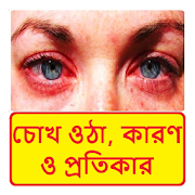 চোখ উঠলে তার চিকিৎসা  ~ Eyes Disease Treatment  Icon