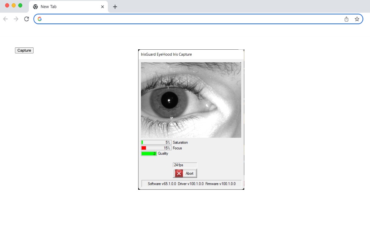 EyeBankWeb Plugin Adapter Preview image 0