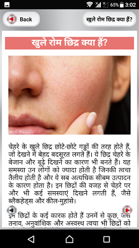 Open Pores Treatment  खुले रोम छिद्रों से राहत