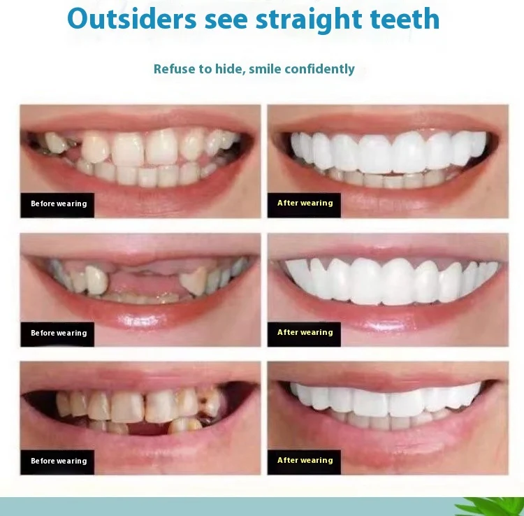 Simulacija zuba i zubne duplje za prirodno jedenje. Uživajte u realističnijem i udobnijem iskustvu jedenja uz ovaj artefakt.