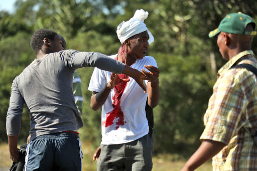 BLOOD FLOWS: One of the residents injured by police rubber bullets after locals took to the streets to protest lack of services in Needs Camp yesterday Picture: MARK ANDREWS