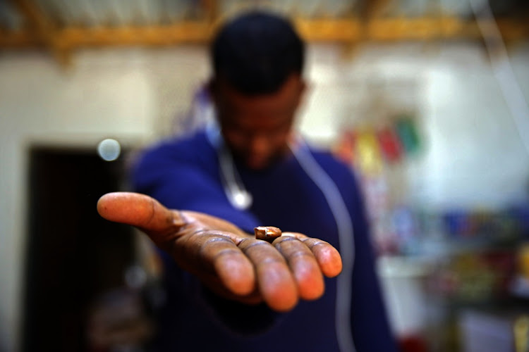A 26-year-old man holds a piece of bullet after he was one of several Somali shop owners and caretakers who were attacked in Atteridgeville last week.