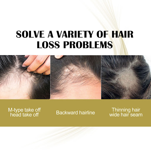 Title 4, Repair Hair with Ginger Roller Care Suit. Resto...