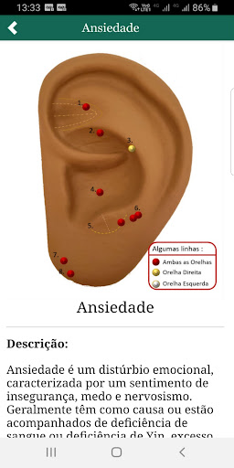 NoPonto Auriculoterapia