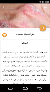 وصفات علاج بالأعشاب ‎(圖4)-速報App
