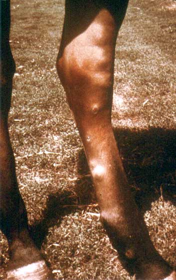 Nodules of sporotrichosis.