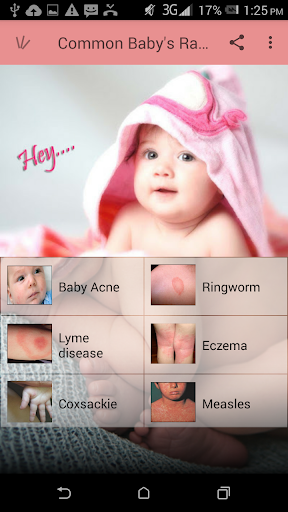 Baby's Rash Guide