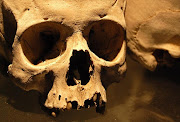 Human skull. File photo.