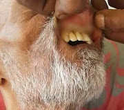 A screenshot from the video which shows a maggot infestation inside the mouth of a 52-year-old Durban man Sadick Ebrahim.