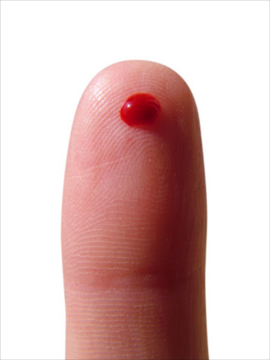 Bleeding finger. File photo