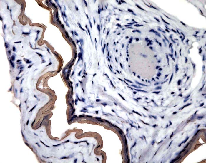 There is very weak cytokeratin staining of the amnion on cord and membrane