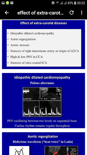 Guide to Doppler Ultrasound Of Carotid arteries