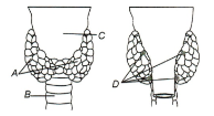 Thyroid