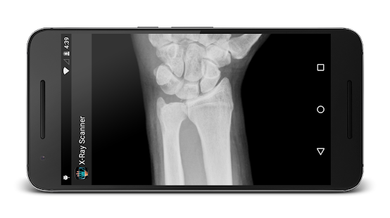 X-Ray  Scanner Prank-Camera Body Scanner Simulator Screenshot