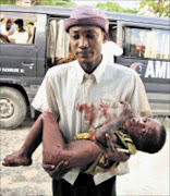 A man claiming to be a relative carries a young child who was wounded during clashes between Islamic fighters and government soldiers, as they arrive at Medina hospital in Mogadishu, Somalia, Friday, May 22, 2009.  Renewed fighting between government troops and Islamist insurgents in the Somali capital killed seven people on Friday, residents and an independent radio station said. Residents reported heavy shelling in the heart of the city. (AP Photo/Farah Abdi Warsameh)