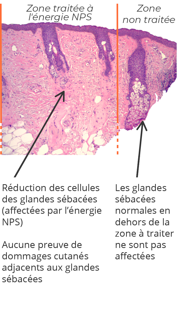 contrôle des marges