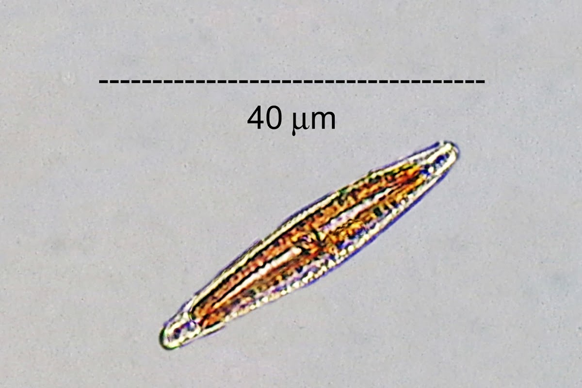 Epilithic Diatom