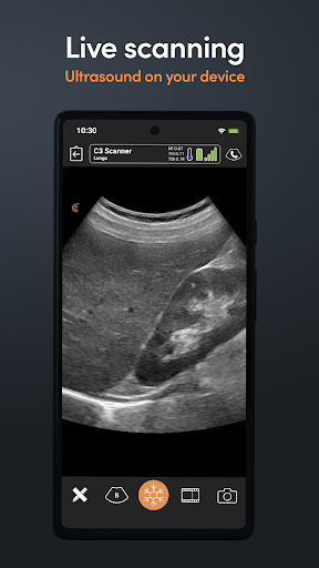 Screenshot Clarius Ultrasound