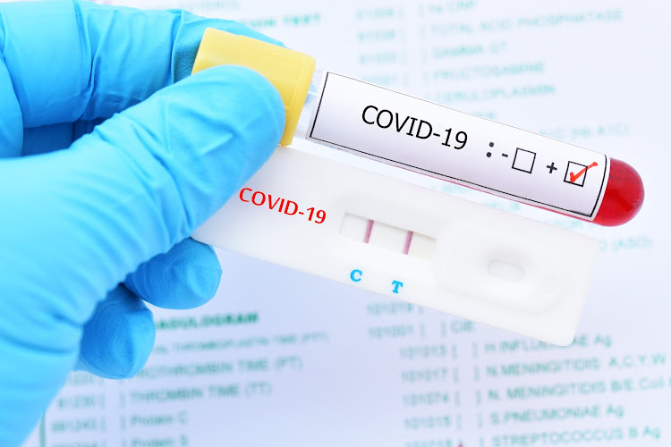 According to experts, purposely contracting Covid-19 is not recommended.
