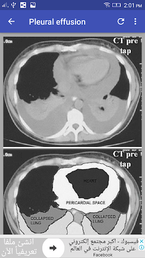 CT Chest Interpretation