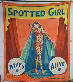 Spottedgirl L