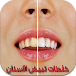 خلطات تبيض الاسنان Apk