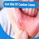 Download How To Get Rid Of Canker Sores (Causes+Remedies) For PC Windows and Mac 1.0.0