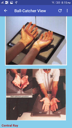 Upper Limb Radiographic Positioning