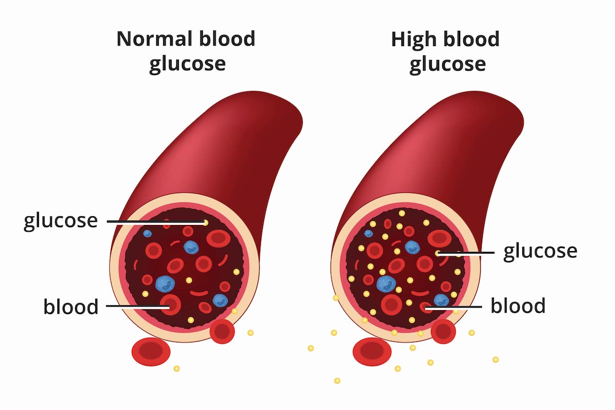 pre diabetes treatment drugs