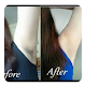 Download Whitening the armpits For PC Windows and Mac 1.0