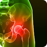 Cure Tight Hips Forever Apk