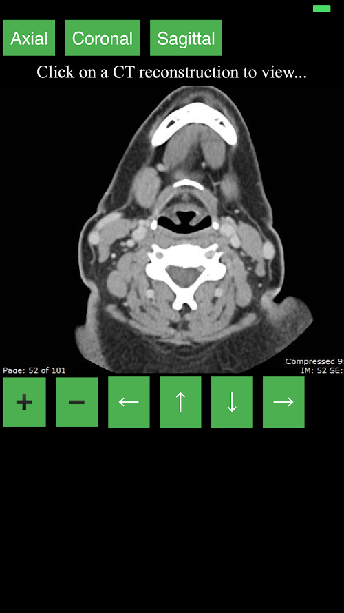 Android application CT Neck screenshort