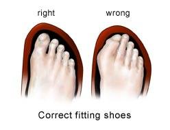 F:\aura\webpage\plastic and reconstructive surgery\diabetic foot care\feet_3.jpg