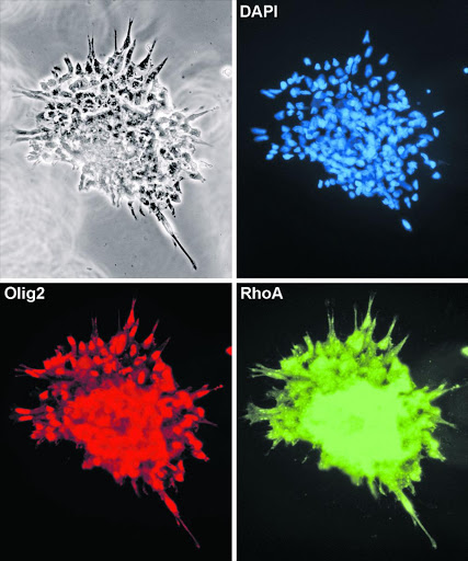 Human embryonic stem cells