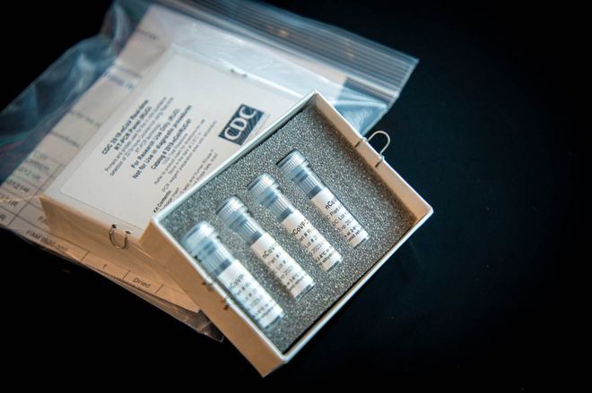 A Coronavirus laboratory test kit used by the CDC