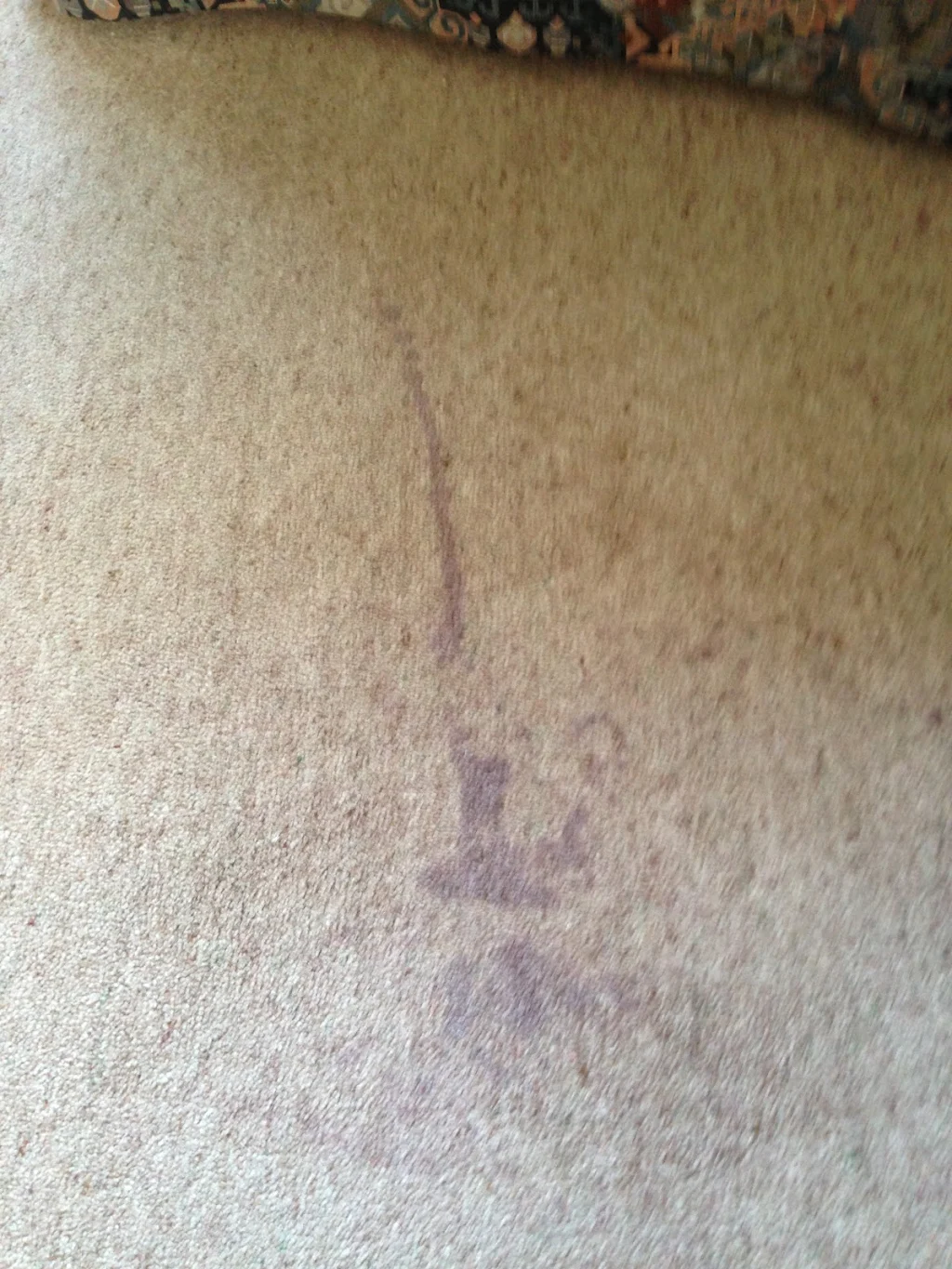 Tea Stain