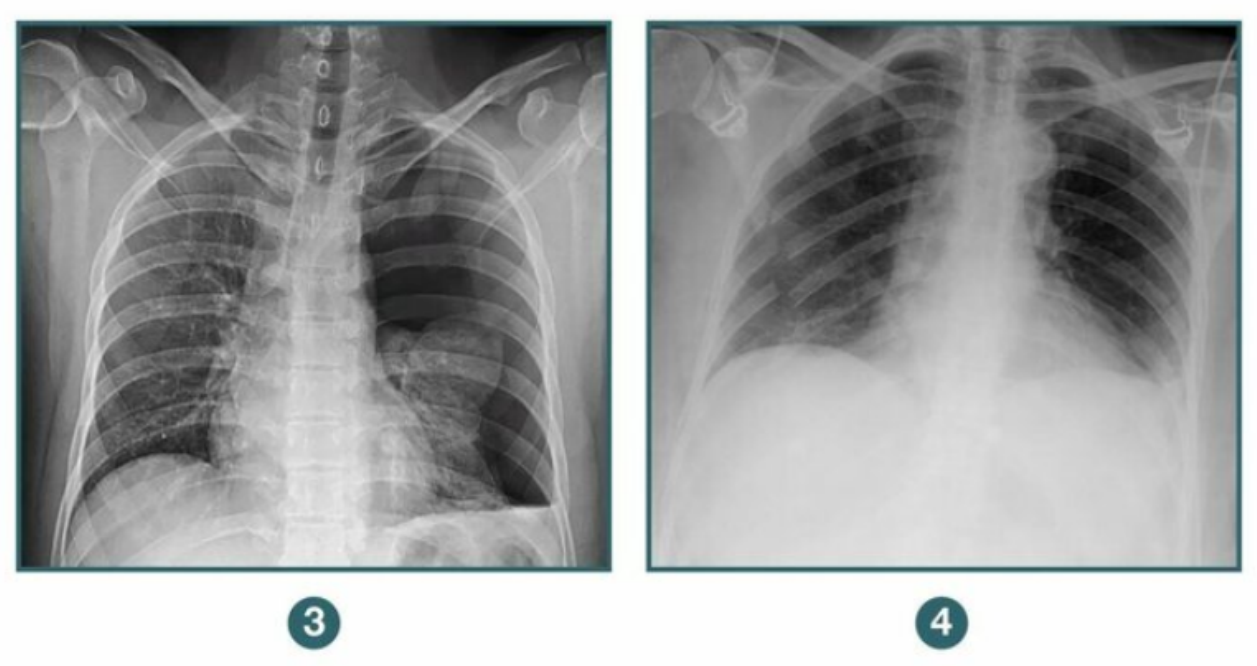 Gastrointestinal Radiology