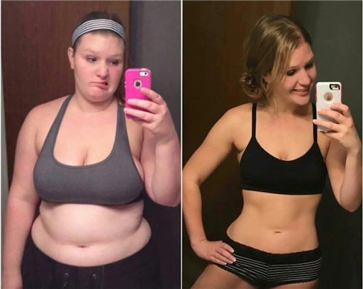 Japanese Method For Losing Weight: High protein foods for gstric byss ptients d...