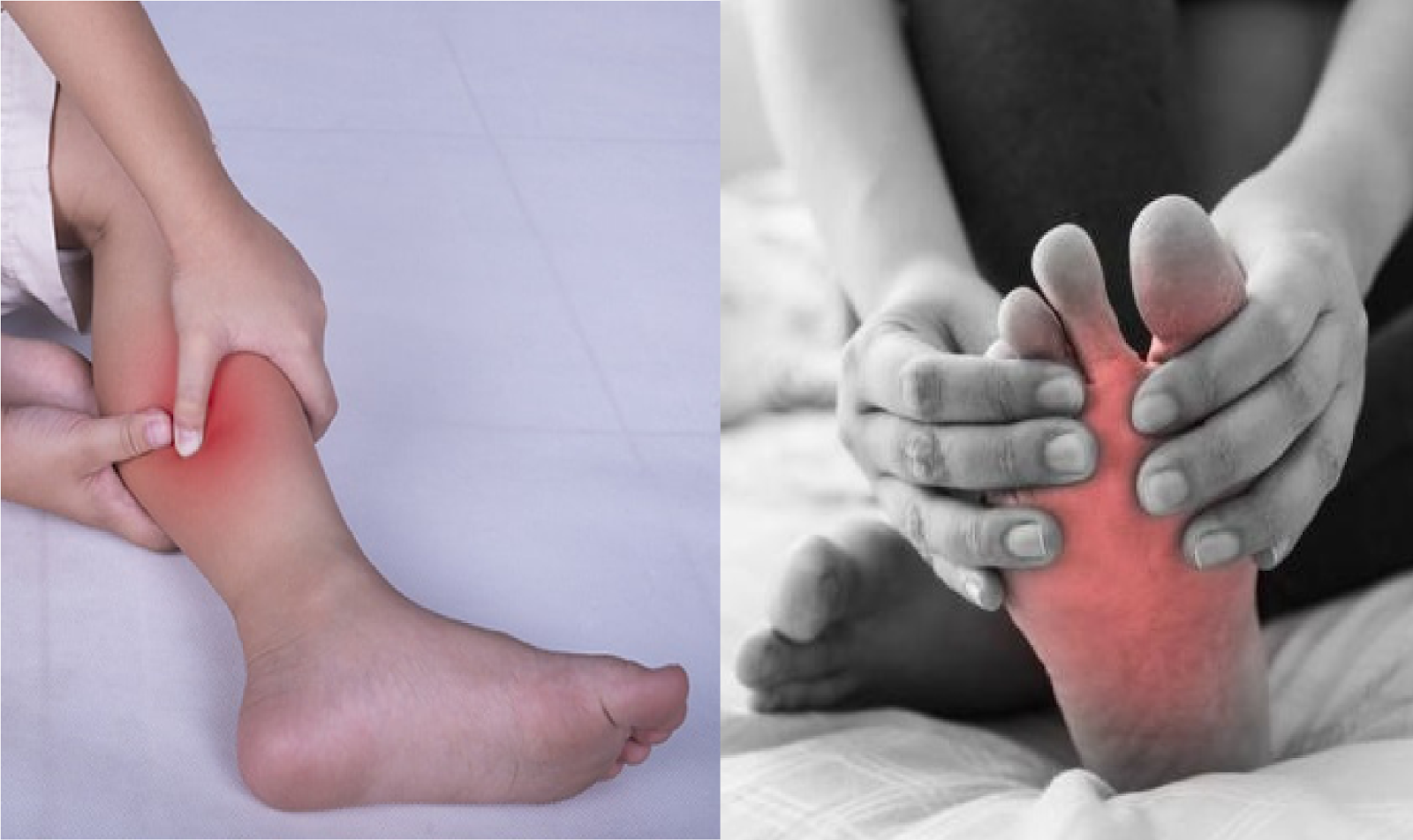 Bị căng có có nguy hiểm không?